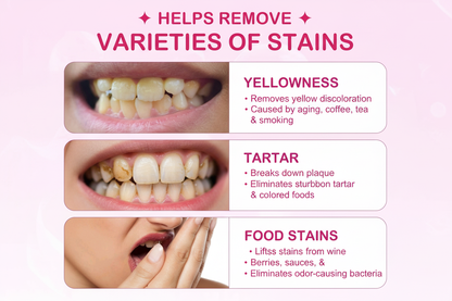 Detailed Teeth Whitening Benefits Guide